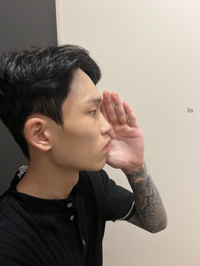 before photo: 코끝(보형물)