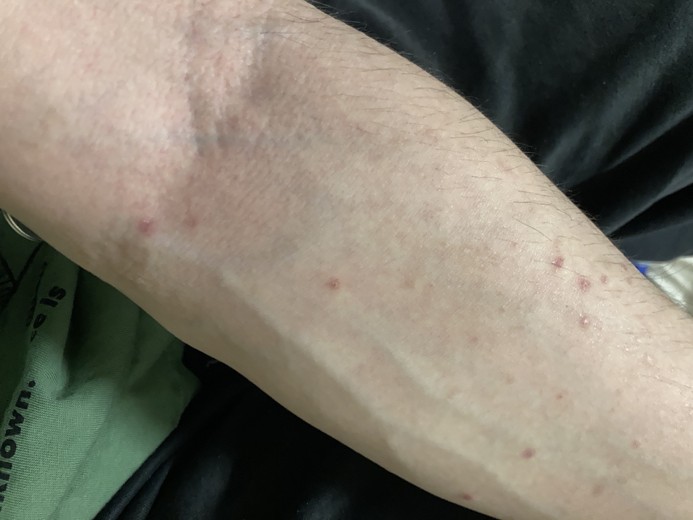 before photo: エクソソーム, 美容注射・点滴