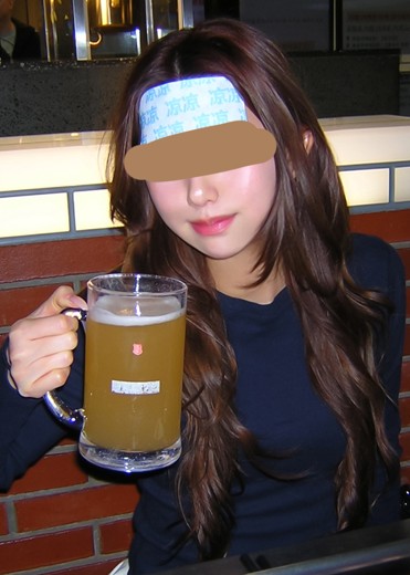 after photo: チューンフェイス(リフトアップ), 脂肪溶解注射(顔)