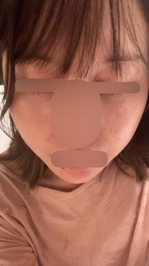 before photo: ルメッカ