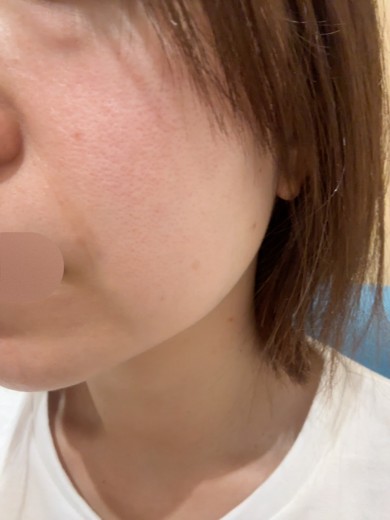before photo: エレクトロポレーション, 診断・検査