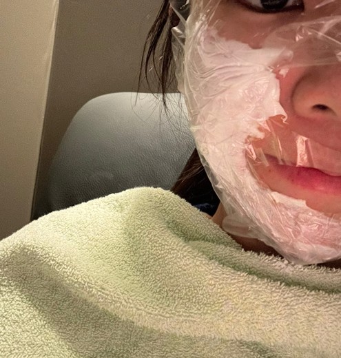 before photo: 티타늄리프팅