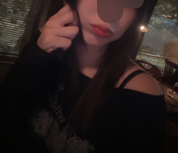 after photo: 입술필러