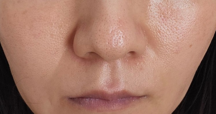 ピーリング　エレクトロポレーション エレクトロポレーションキュベット #1652089 | Bio-Rad