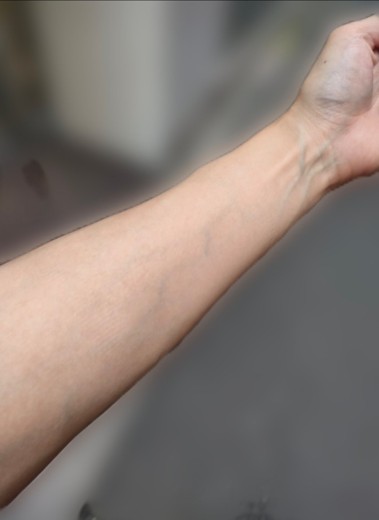after photo: 白玉注射・点滴