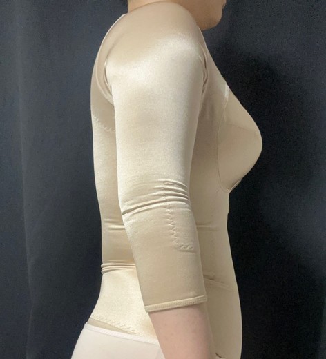 after photo: 전신지방흡입