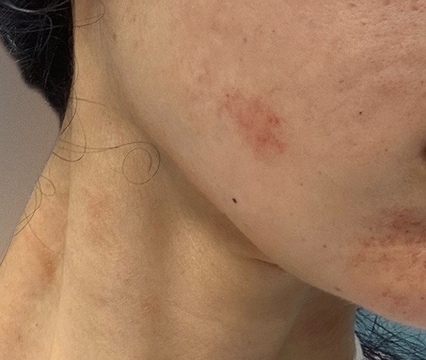 before photo: 診断・検査