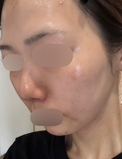 after photo: ルメッカ