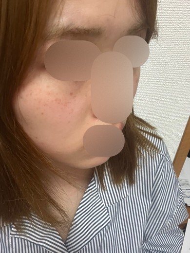 after photo: ルメッカ