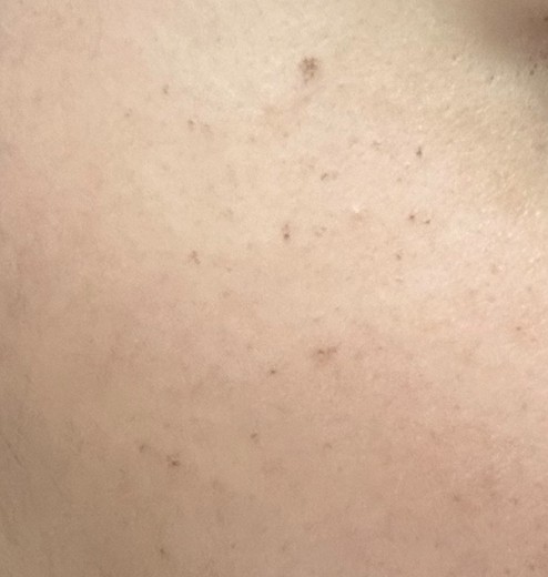 after photo: ルメッカ