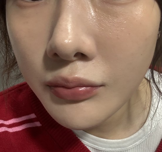 after photo: 쥬베룩