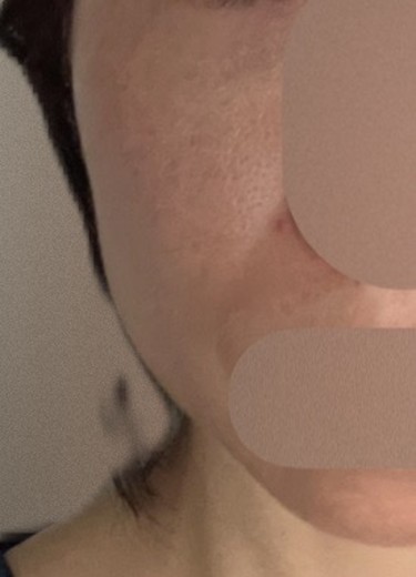 after photo: ボルニューマ