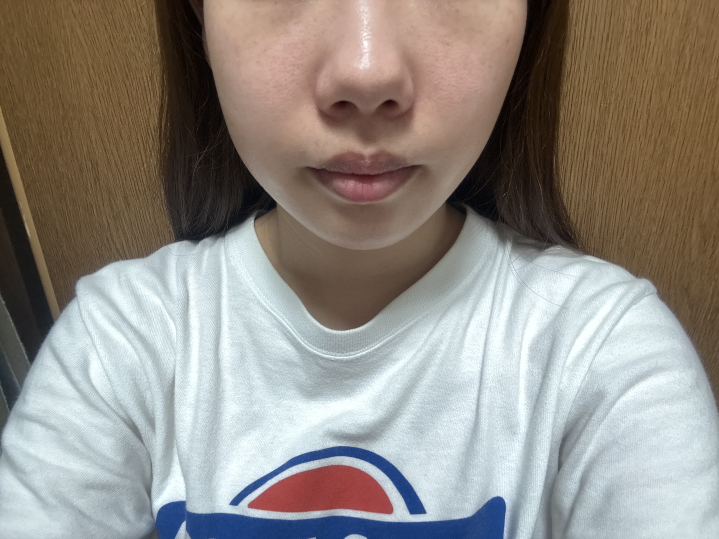 アクアピール＋エレクトロポレーション【薬剤代込】【再来OK