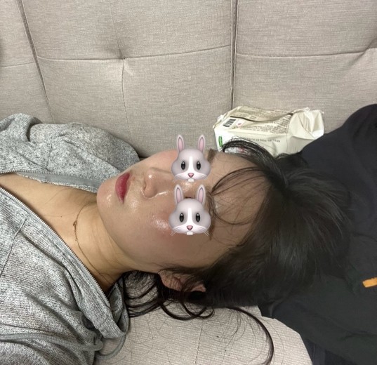 after photo: 리쥬란힐러