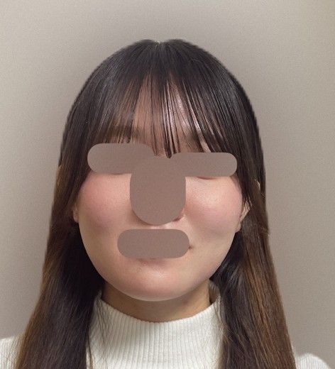 before photo: ヴェルベットスキン