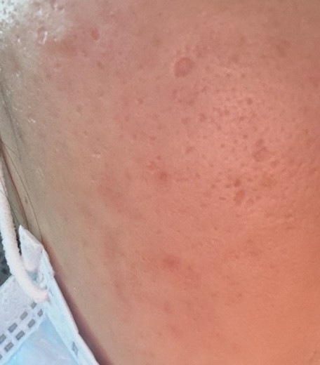 after photo: 쥬베룩