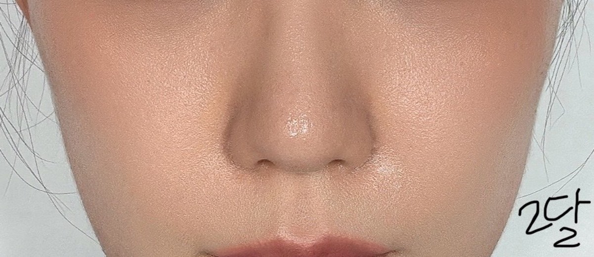 after photo: 쥬베룩