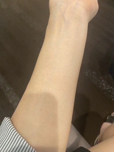 before photo: 白玉注射・点滴