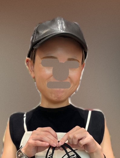 before photo: ウルトラセルQ+(ハイフ)