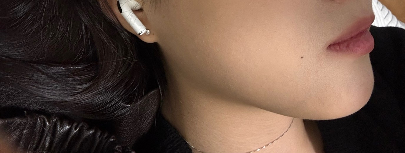 after photo: 슈링크유니버스