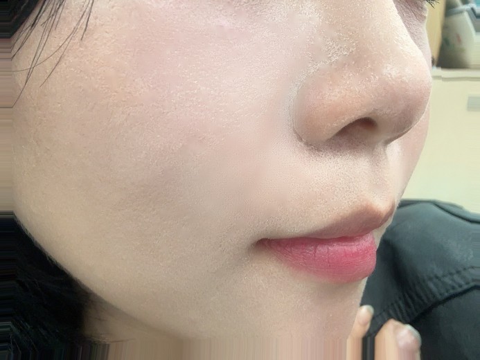 after photo: 쥬베룩