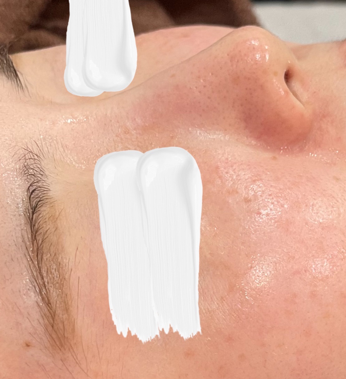 再来OK】ハイドラフェイシャル＋エレクトロポレーション | おおかみ