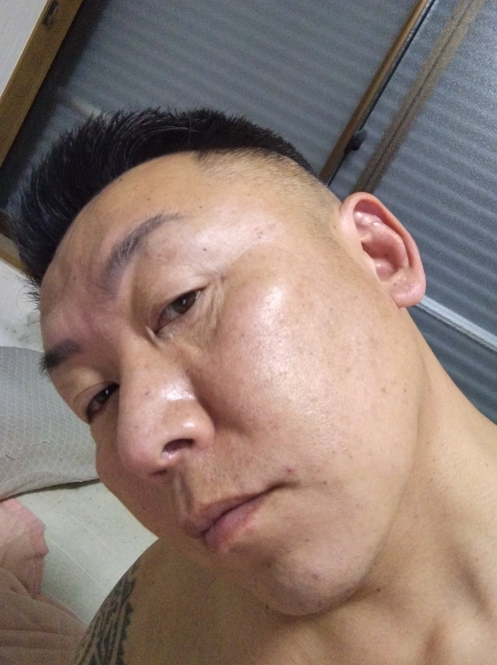 Ｃ【初手術限定】鼻先肋軟骨-ｵﾌﾟｼｮﾝから麻酔まで込々〖定額プラン〗 | BIKAN整形外科, image size:1019x1364