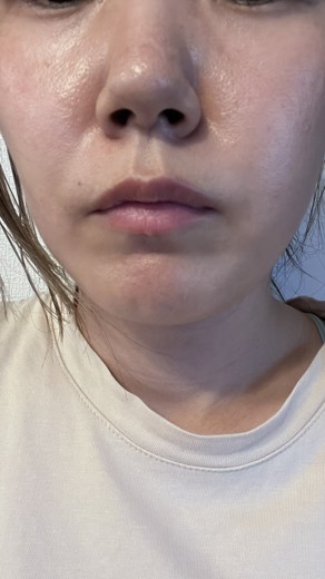 before photo: ジュベルック(Juvelook)