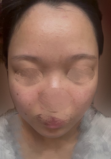 after photo: 診断・検査