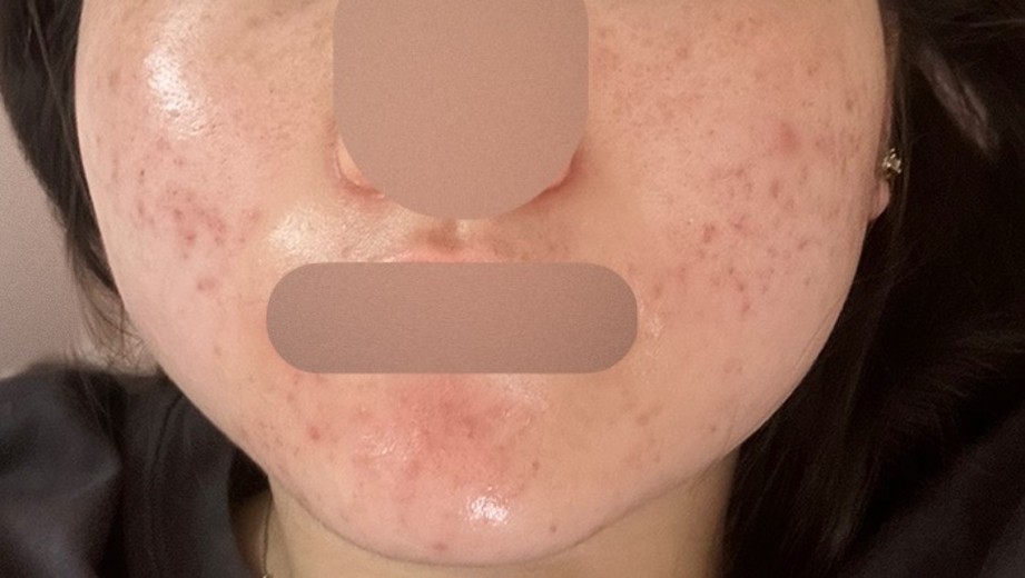 before photo: ルメッカ