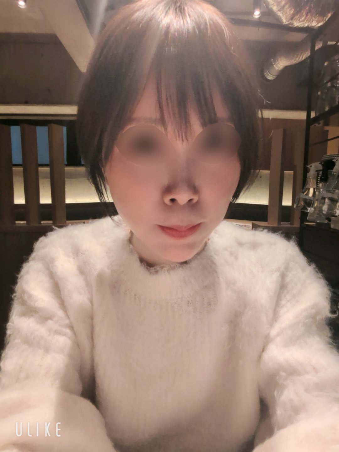 ボトックス施術の後悔と反省｜私の体験談, image size:1080x1440