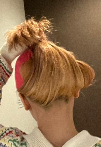 何度でも可】【女性限定】背中＋腰＋うなじセット脱毛｜ジェントル