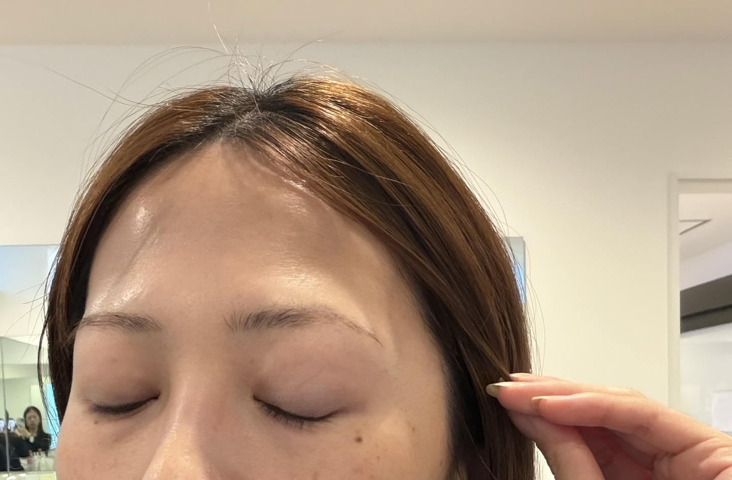 何度でも可】美顔レーザートーニング＋マッサージピール | ZX-CLINIC
