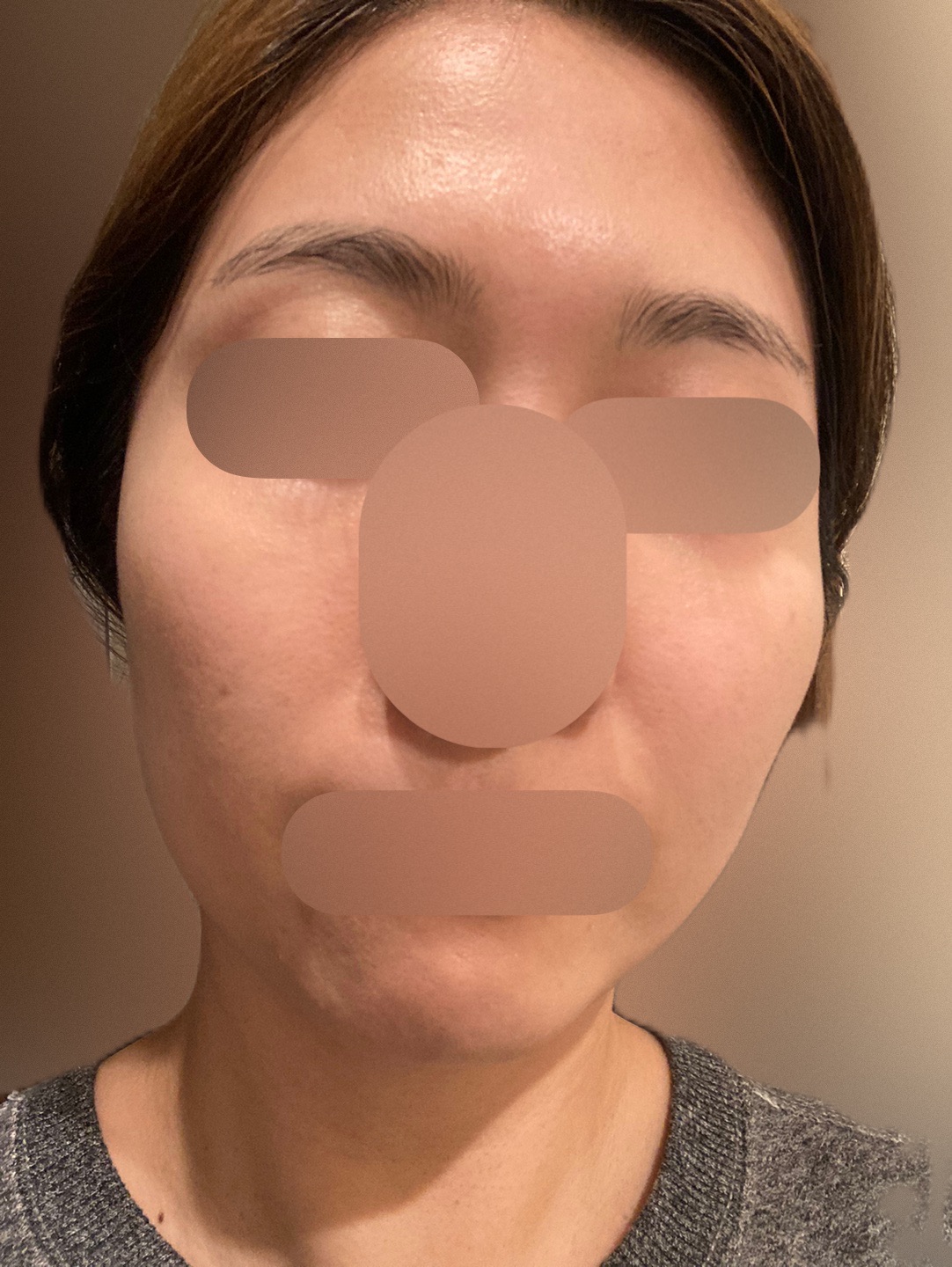 再来OK】ハイドラフェイシャル＋エレクトロポレーション | おおかみ