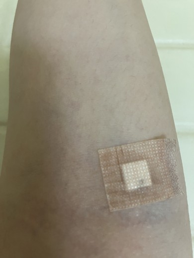 after photo: ビタミン注射・点滴