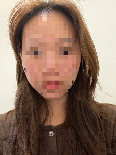 after photo: 포트라리프팅