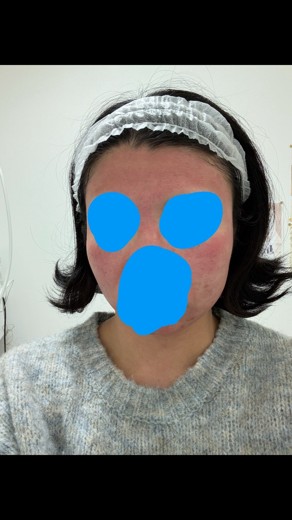 after photo: ポテンツァ(POTENZA)