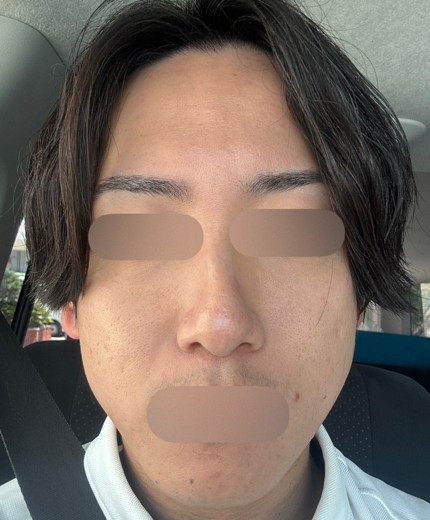 after photo: ポテンツァ(POTENZA)