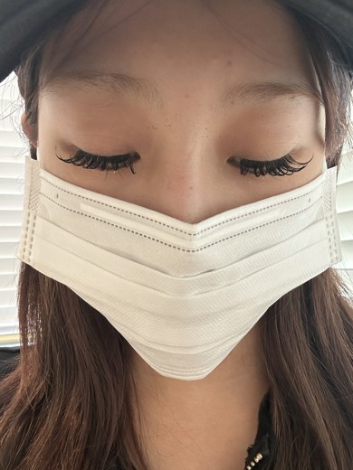 after photo: 美容注射・点滴