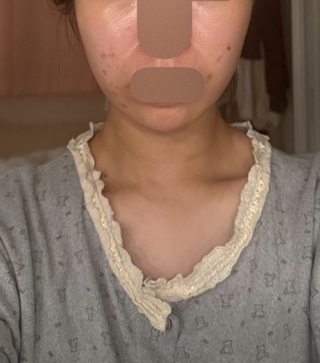 before photo: 슈링크유니버스