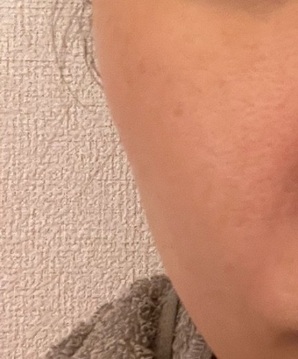 after photo: ポテンツァ(POTENZA), ジュベルック(Juvelook)
