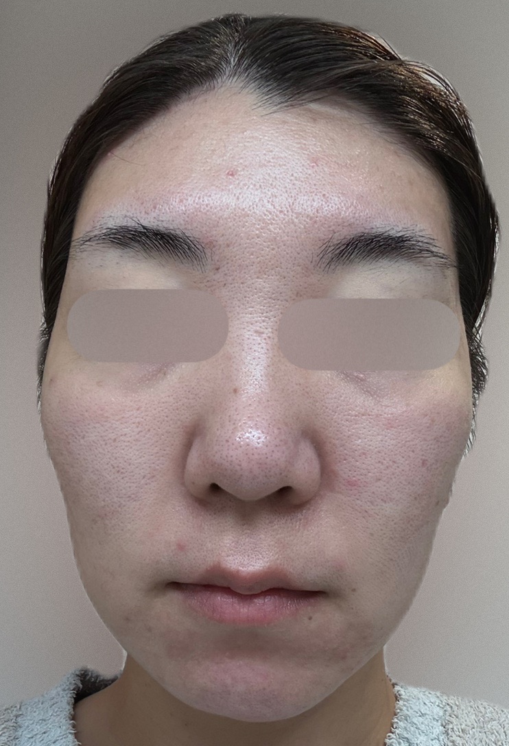 ZX-CLINIC【ゼクスクリニック】の施術口コミ944件