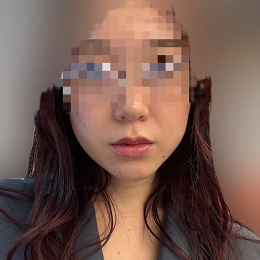after photo: インモード