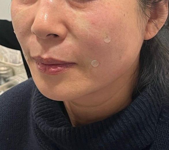 after photo: 쥬베룩