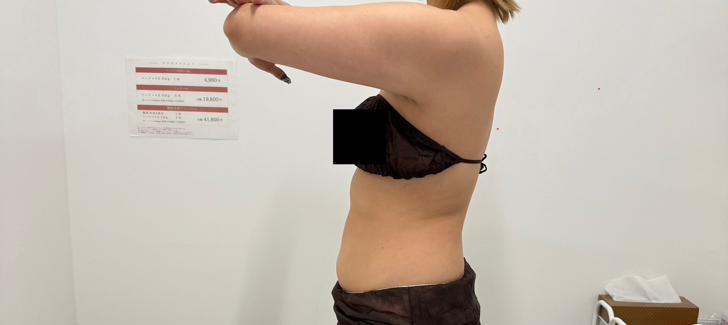 スノエル（脂肪冷却）2パーツ4ハンドル 部分痩せしたい方◎ | オルタ