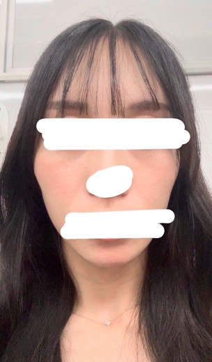 after photo: ルメッカ