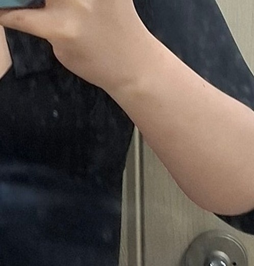 after photo: 인모드바디