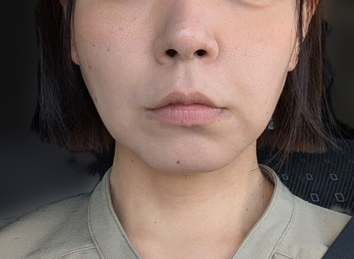 after photo: ソノクイーン(ハイフ)