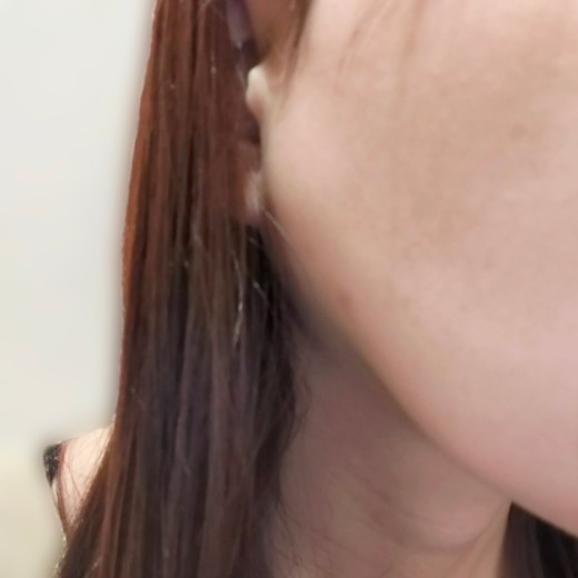 before photo: 白玉注射・点滴