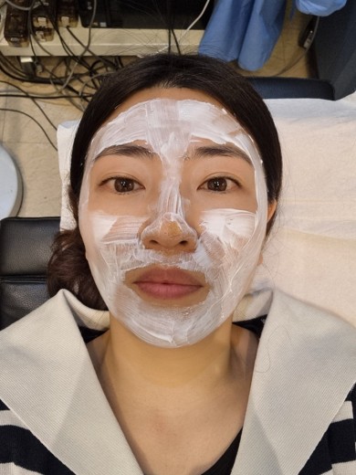 before photo: 프락셀레이저, 디오레듀얼